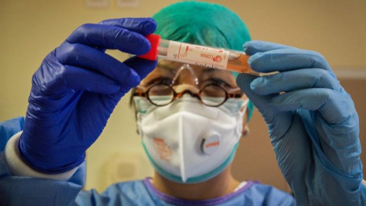 Detectan anticuerpos COVID en sangre y saliva que duran, al menos, tres meses