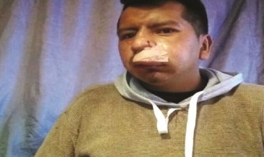 14 heridos y 33 procesados en 25 días de disputa por Adepcoca