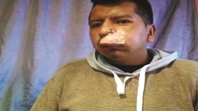 14 heridos y 33 procesados en 25 días de disputa por Adepcoca