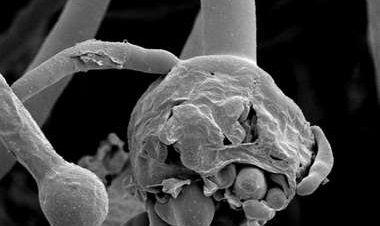 9 datos básicos que tienes que saber sobre el agresivo 'Hongo Negro' y por qué es tan peligroso