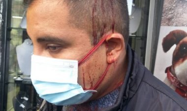 Violencia de grupos de choque del MAS, obligan al Conade a suspender marcha