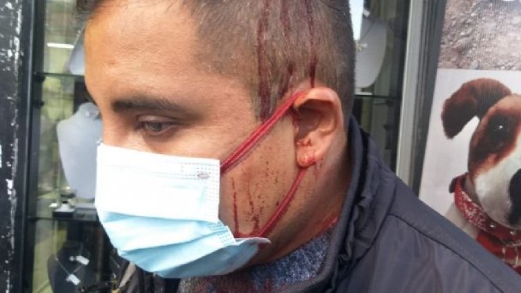 Violencia de grupos de choque del MAS, obligan al Conade a suspender marcha