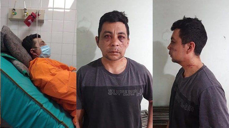 Murió el enfermero neuquino que fue atacado por sus vecinos cuando se contagió de COVID-19