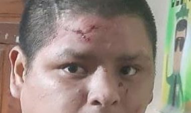 La policía aprehende a un ‘motochorro’ en Tarija