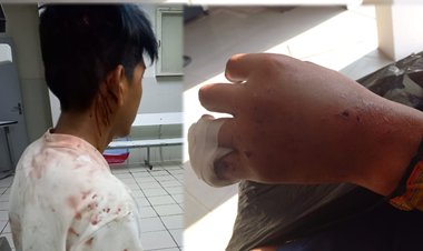 Santa Cruz: Detienen a un hombre que intentó asesinar a su hermano menor este domingo