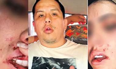 Modelo, víctima de violencia: “Me armé de valor para denunciarlo y acabar con este sufrimiento”