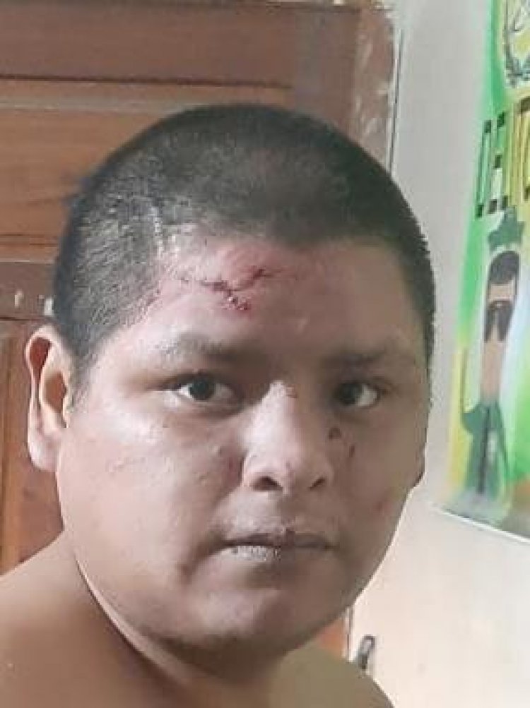 La policía aprehende a un ‘motochorro’ en Tarija