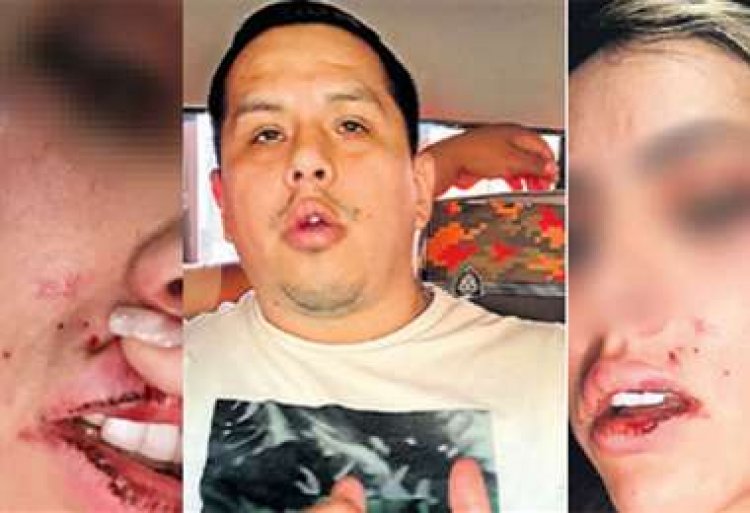 Modelo, víctima de violencia: “Me armé de valor para denunciarlo y acabar con este sufrimiento”