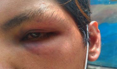 Joven fue golpeado por cuatro sujetos durante el paro en Tarija