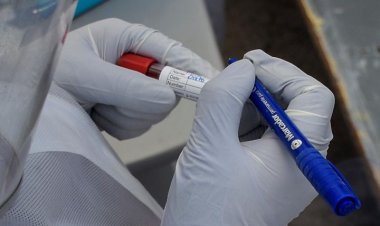 Salud ratifica que aún no se detectó la Ómicron en Bolivia, pero existe la sospecha