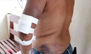 "Ya me cansé de los maltratos, no quiero vivir con él"; una mujer denuncia al padre de sus hijas que la golpeó y roció alcohol para quemarla