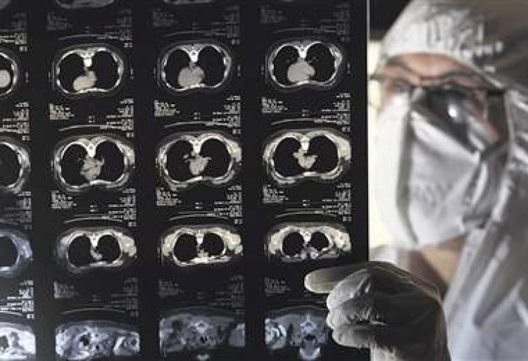 Alertan de casos de flurona y posible muerte; el Sedes aguarda informe