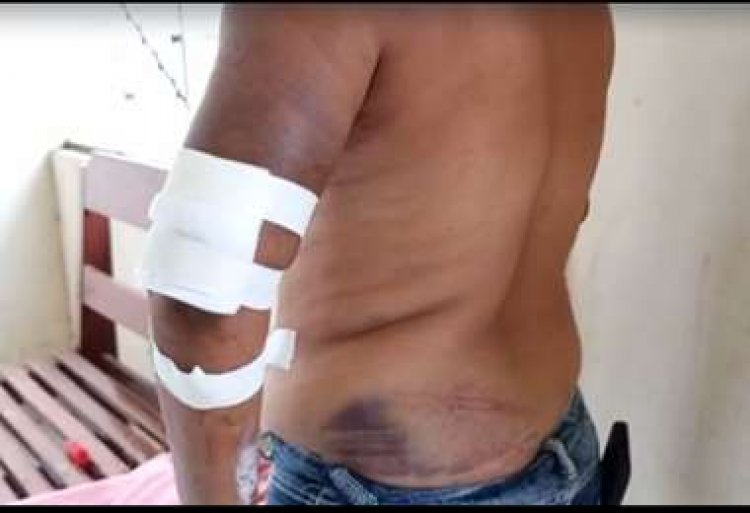 "Ya me cansé de los maltratos, no quiero vivir con él"; una mujer denuncia al padre de sus hijas que la golpeó y roció alcohol para quemarla