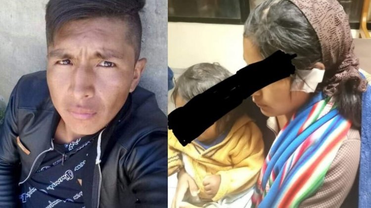 A Adela, una joven embarazada, su concubino le quitó parte de la oreja; él está prófugo