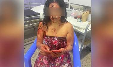 Mujer se salva de milagro después de ser atacada con un cuchillo por su concubino