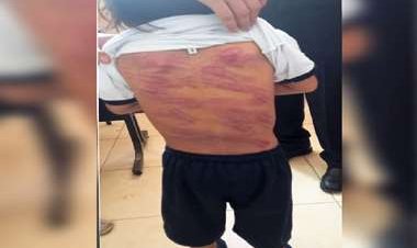 Profesores de un colegio descubren que un niño de 4 años con síndrome de Down fue flagelado por su padre