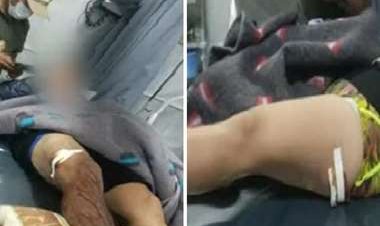 Santa Cruz: Un sujeto balea tres veces a una pareja cuando cenaba en un restaurante