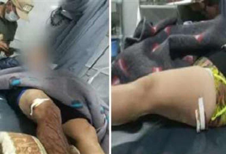 Santa Cruz: Un sujeto balea tres veces a una pareja cuando cenaba en un restaurante
