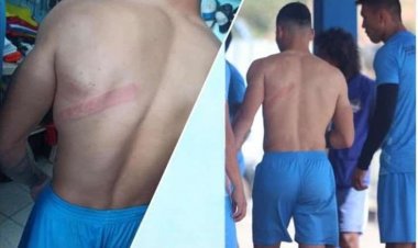 ¡Escándalo! Hinchas de Blooming chicotean a un jugador y dañan vehículos de futbolistas