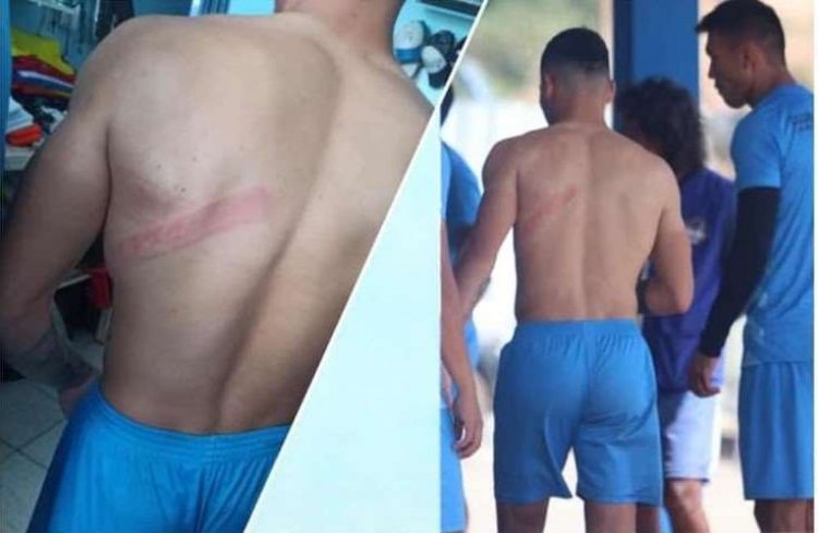 ¡Escándalo! Hinchas de Blooming chicotean a un jugador y dañan vehículos de futbolistas