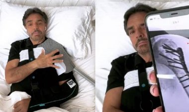 Derbez tuvo 15 fracturas y cuenta, con la voz entrecortada, detalles de su accidente