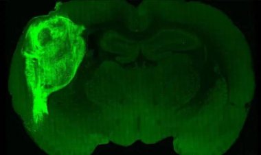 Implantan “minicerebros” derivados de células humanas a ratas recién nacidas