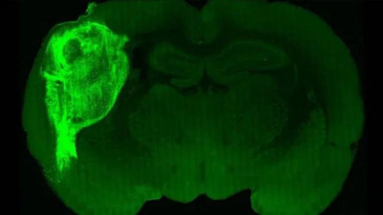 Implantan “minicerebros” derivados de células humanas a ratas recién nacidas