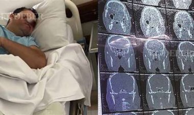 Fallece el hombre que perdió un ojo por un disparo de la Policía en inmediaciones de El Cristo