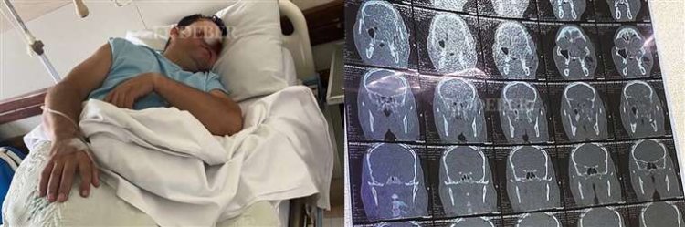 Fallece el hombre que perdió un ojo por un disparo de la Policía en inmediaciones de El Cristo