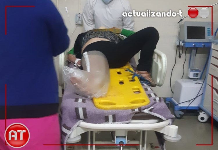 Accidente de un motociclista y su acompañante en Tarija termino con la vida del conductor.