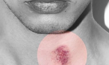 Un joven muere tras un ‘chupón’ que le hizo su novia