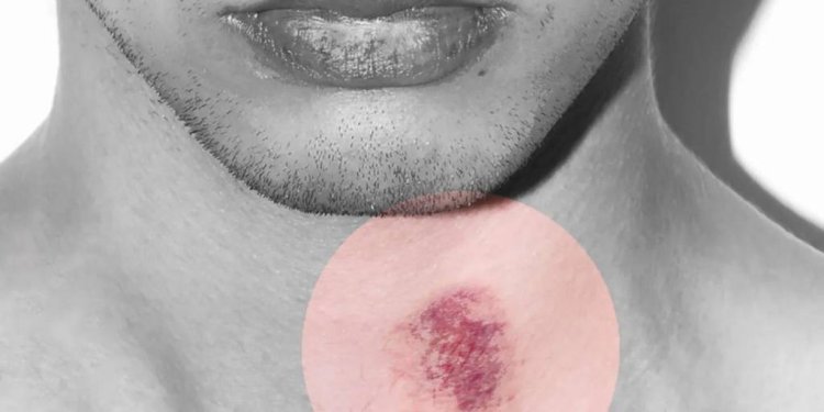 Un joven muere tras un ‘chupón’ que le hizo su novia