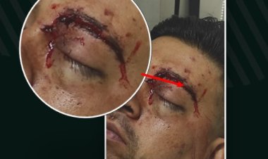 Violenta pelea en una boda dejo una persona herida y un aprehendido