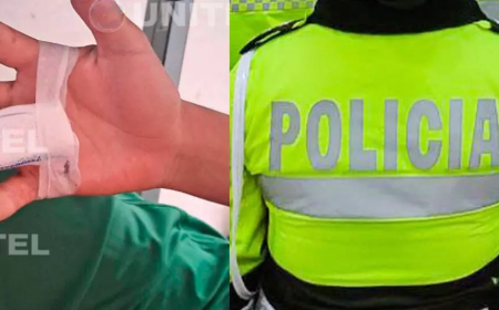 Atacaron con machete a estudiante de 15 años y le inmovilizaron 3 dedos de su mano