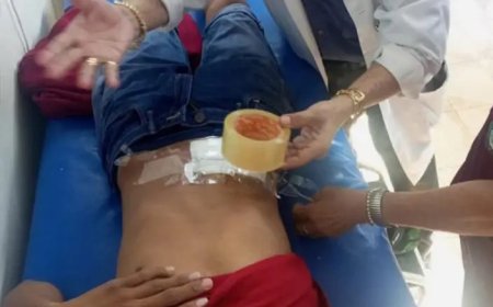 Médicos de Riberalta usaron ‘yúrex’ por falta de cinta médica; Alcaldía niega desabastecimiento.