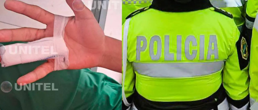 Atacaron con machete a estudiante de 15 años y le inmovilizaron 3 dedos de su mano