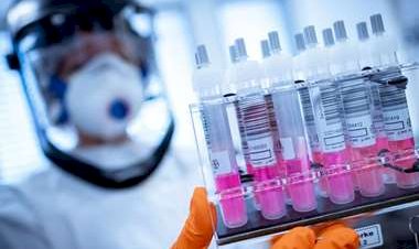 Bolivia tendrá 450.000 pruebas para diagnosticar Covid-19 en las próximas semanas