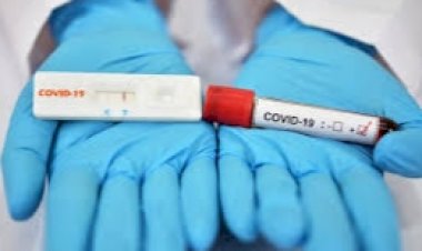 Ministerio de Salud determinó no aplicar la segunda prueba en pacientes recuperados