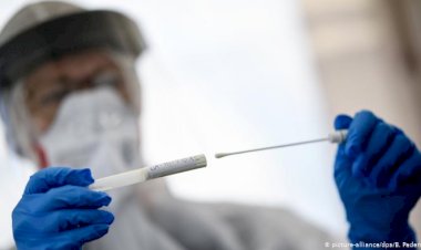 Gobierno reporta 851 nuevos casos y Bolivia acumula 110.999 contagios de COVID-19