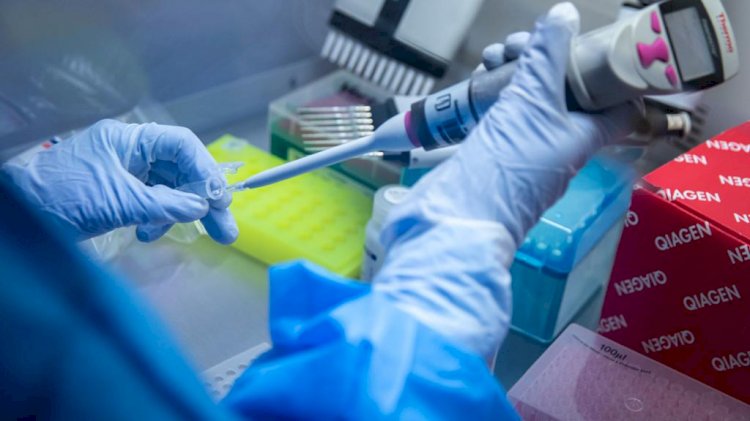 Cuatro países ensayan vacuna contra el Covid-19 en humanos