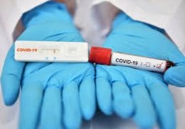Ministerio de Salud determinó no aplicar la segunda prueba en pacientes recuperados